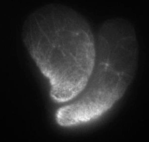 Confocal laser scanning microscopy image showing two stable-bleb cells from gastrulating zebrafish embryos expressing Lifeact (white) to visualize their actomyosin cytoskeleton. / © Verena Ruprecht and Carl-Philipp Heisenberg