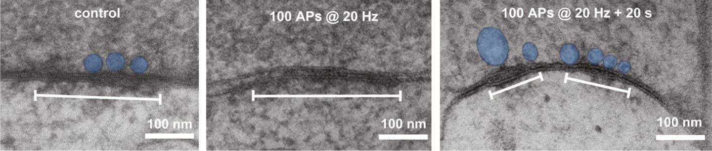 A photo of the potential engram: Without activity, only few vesicles are found at the synapse. After a short burst of activity, vesicles dock at the synapse. The pool of vesicles is stored at the synapse even minutes later. This pool may be the physical trace of memory, the "engram".