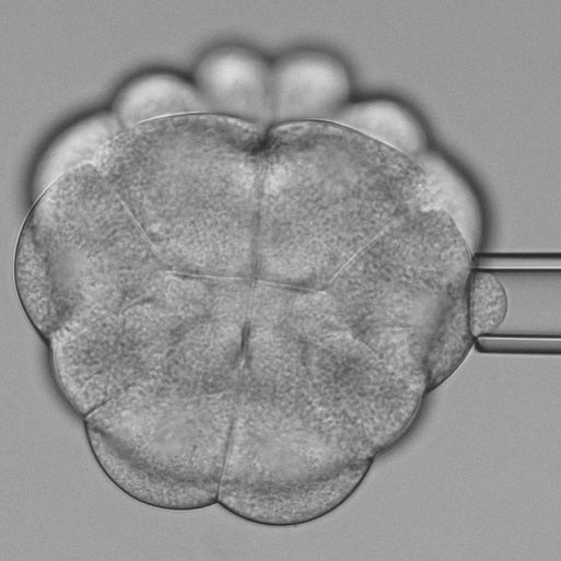 Measuring the stiffness of dividing cells An ascidian consisting of 24 cells. The stiffness of the cells preparing for cell division is measured with a micropipette. © Benoit Godard / IST Austria