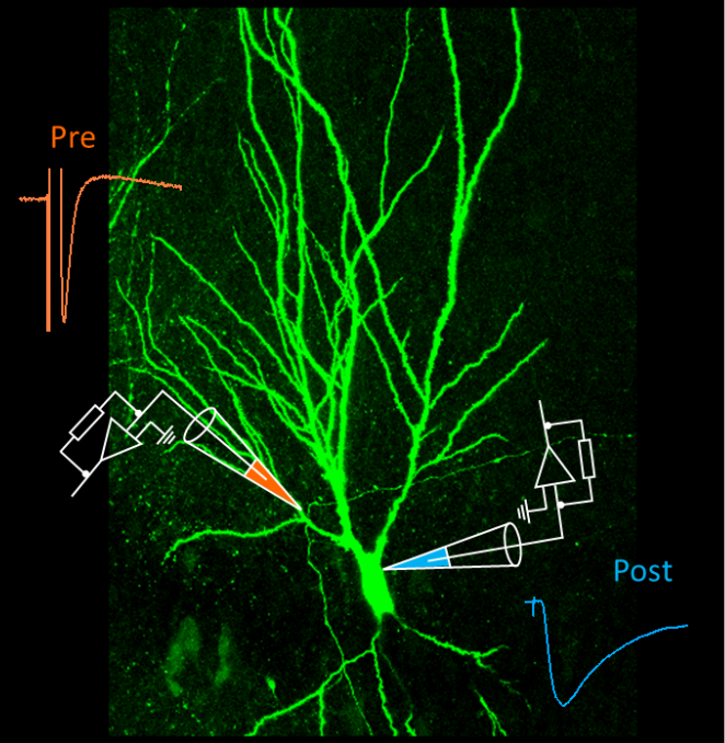 Moosfaser-Synapse im Hippocampus, ein „smarter Lehrer“. Bild zur Verfügung gestellt von David Vandael und Yuji Okamoto, adaptiert von Vandael et al. Nature Protocols, in press. © IST Austria