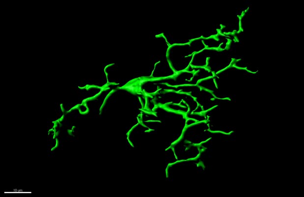 In the healthy brain of adults, microglia stretch trough the tissue checking if pathways are functioning correctly. © Gloria Colombo/Siegert group/IST Austria