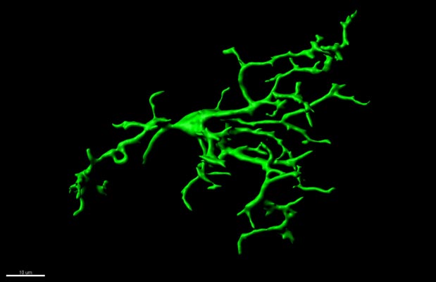 In the healthy brain of adults, microglia stretch trough the tissue checking if pathways are functioning correctly. © Gloria Colombo/Siegert group/IST Austria
