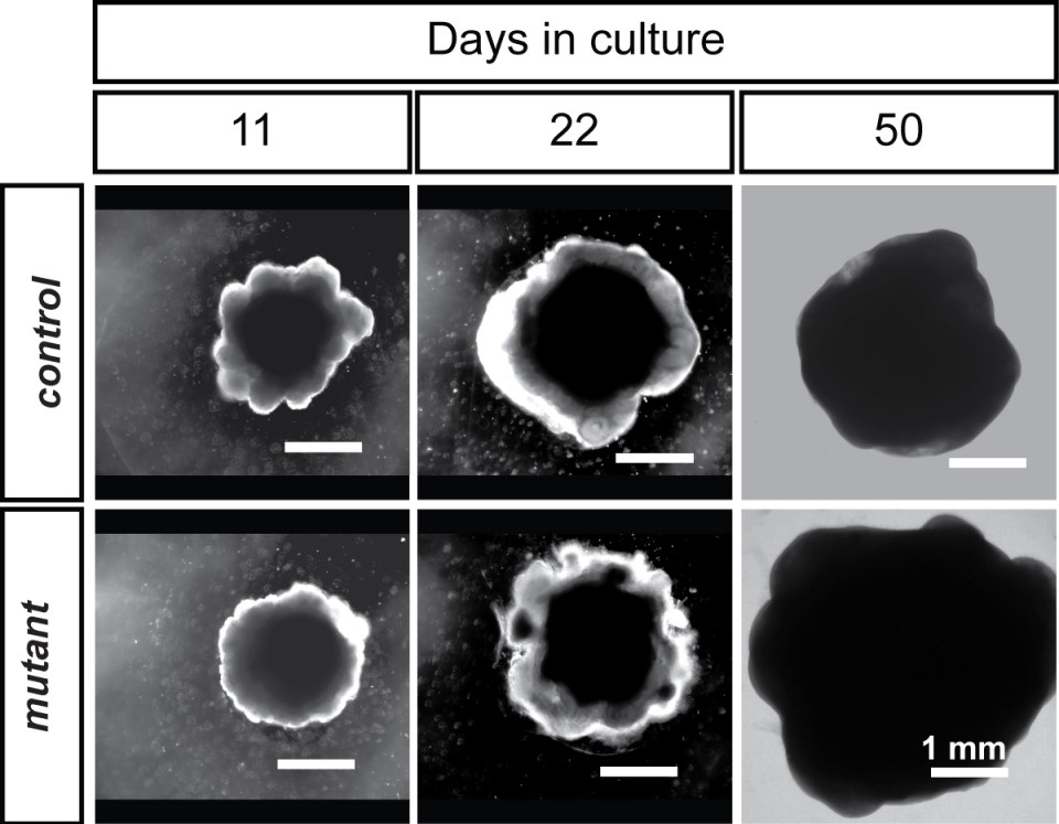 Brain Organoids Comparison (c)Novarino Group ISTA