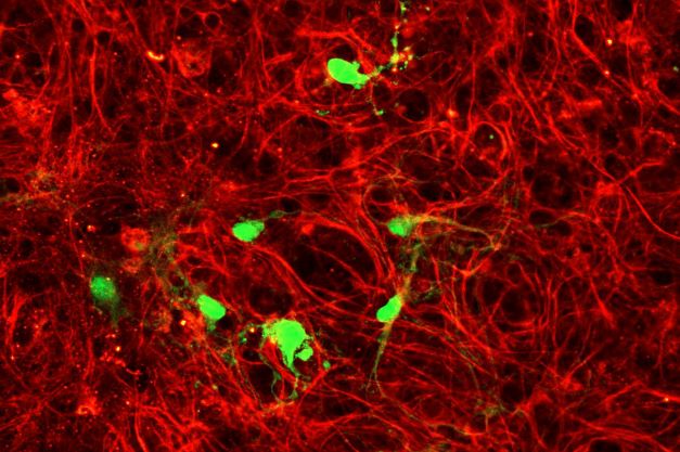 Immune Cells Infected With Adenoassociated Virus (AAV9) 3to2ratio (c) Yvonne Vallis ISTA 255x235