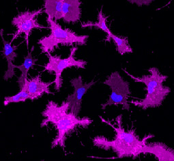 Microglia cells producing engineered receptors