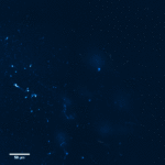 Menschliche CA3-Pyramidalneuronen, aufgenommen in einer Patient:innengewebeprobe.