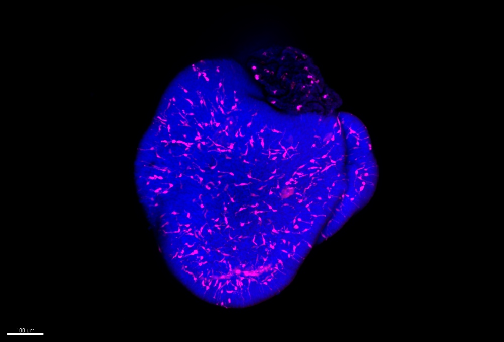 Mikroglia (Magenta), eingebettet in einem retinalen Organoid. Die Zellkerne (Mitte der Zellen) der Neuronen sind blau gefärbt.