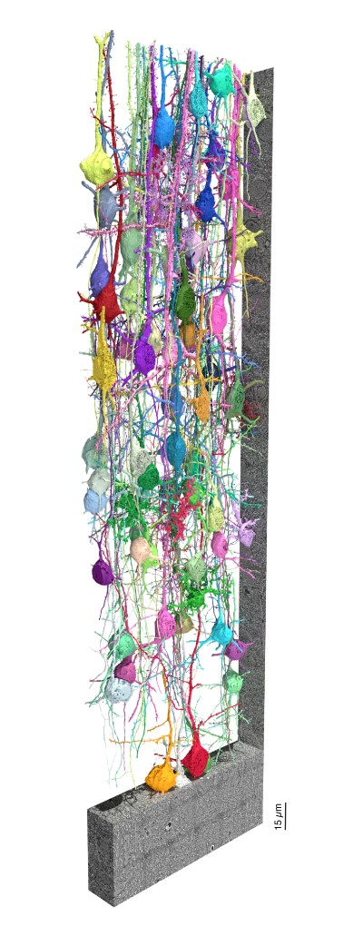 Intricate architecture of a neuronal network.