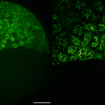 The protein keratin has been labeled with a green fluorescent dye. The process is shown in the left image from a greater distance (scale bar: 100 µm) and in the right image at a magnified view (scale bar: 25 µm).