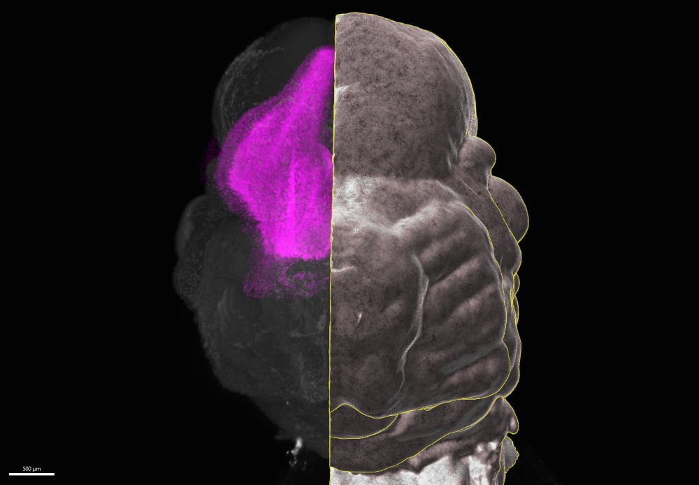 A mouse embryo's head in the early stages of development.